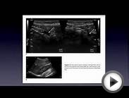 Ultrasound Article Review Nov 2012